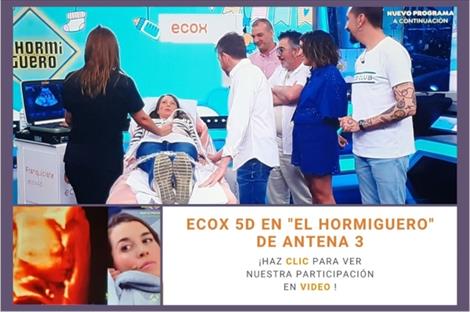 Ecox en el programa prime time de Antena 3, El Hormiguero